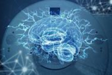 用“成為AI”來對抗AI，馬斯克的腦機是不是個偽命題？