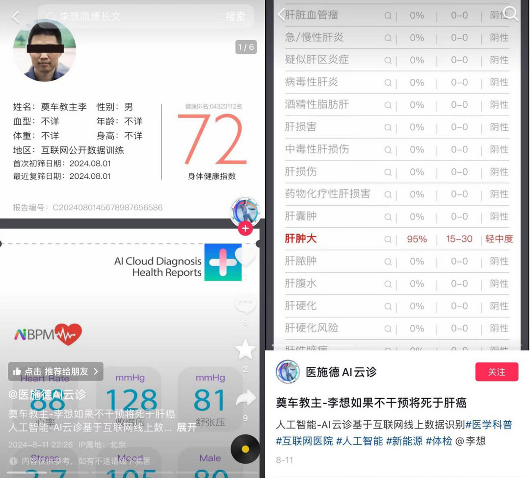 已報警！李想被爆將死于肝癌